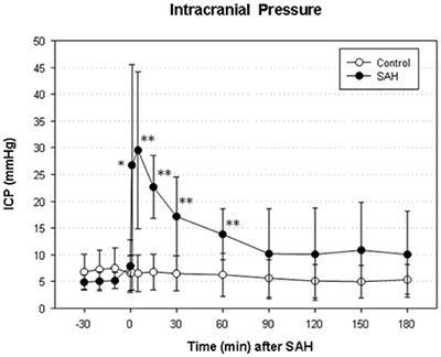 First Description of Reduced Pyruvate Dehydrogenase Enzyme Activity Following Subarachnoid Hemorrhage (SAH)